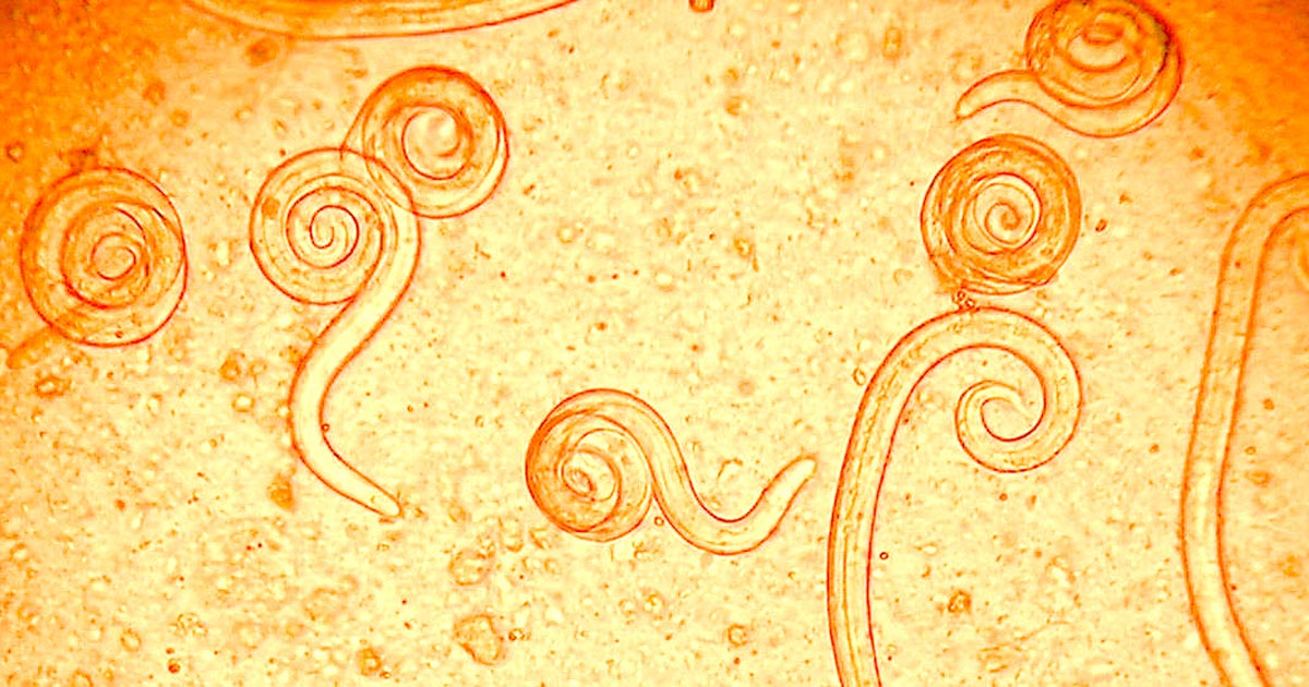 Figure 1. First-stage larvae of the canine lungworm Angiostrongylus vasorum recovered from the faeces of a naturally infected dog.