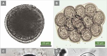 Figure 1. The eggs of Toxocara canis (1a), the common roundworm of dogs; Dipylidium caninum (1b), the common intestinal tapeworm of dogs and cats, also known as flea tapeworm; Echinococcus species (1c), the dwarf tapeworm; and the dog hookworm Ancylostoma caninum (1d).