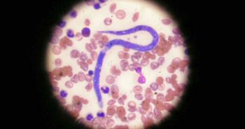 Figure 1. The microfilaria heartworm. Image: Pedro Serra / NationWide Labs