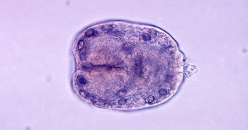 Protoscolex of Echinococcus granulosus from hyatid cyst.