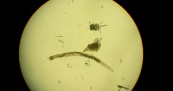 Figure 1. A free-living soil nematode.